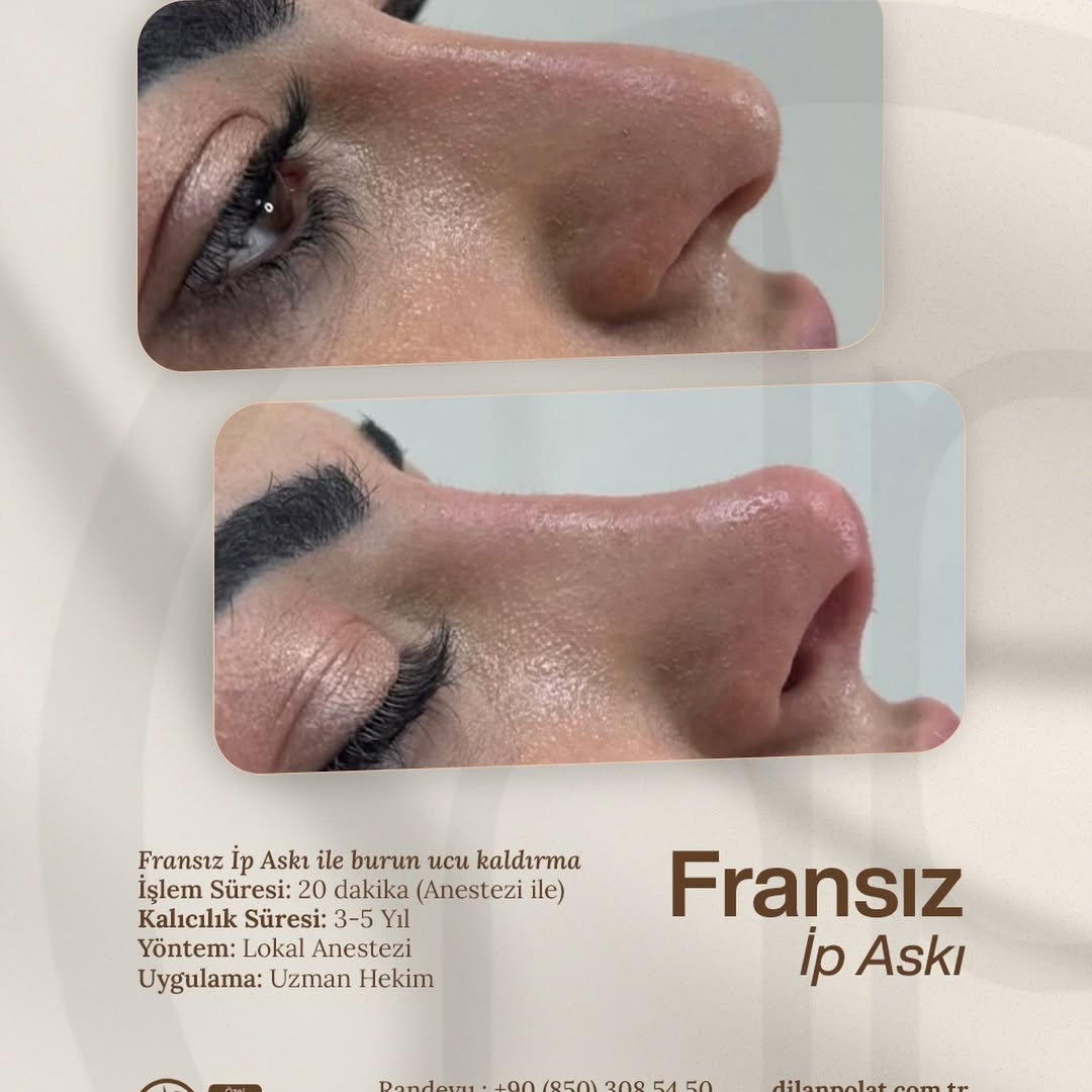 Profilinizin mükemmel açısını keşfetmek için neştere ihtiyac